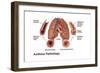 Asthma Pathology-Gwen Shockey-Framed Art Print