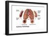 Asthma Pathology-Gwen Shockey-Framed Art Print