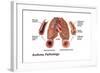 Asthma Pathology-Gwen Shockey-Framed Art Print