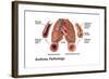 Asthma Pathology-Gwen Shockey-Framed Art Print