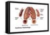 Asthma Pathology-Gwen Shockey-Framed Stretched Canvas