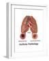 Asthma Pathology-Gwen Shockey-Framed Art Print