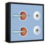 Astigmatism and Correction with Corrective Lens-null-Framed Stretched Canvas