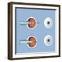 Astigmatism and Correction with Corrective Lens-null-Framed Art Print