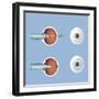 Astigmatism and Correction with Corrective Lens-null-Framed Art Print