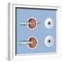 Astigmatism and Correction with Corrective Lens-null-Framed Art Print