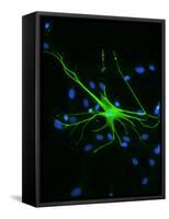 Astrocyte Nerve Cell-Riccardo Cassiani-ingoni-Framed Stretched Canvas