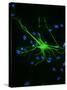 Astrocyte Nerve Cell-Riccardo Cassiani-ingoni-Stretched Canvas