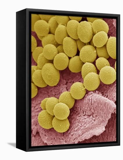 Athlete's Foot Fungus, SEM-Steve Gschmeissner-Framed Stretched Canvas