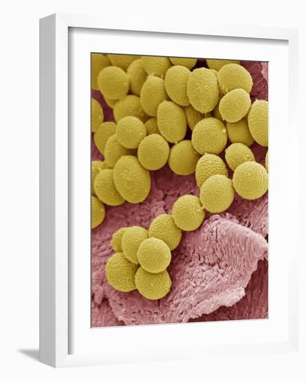 Athlete's Foot Fungus, SEM-Steve Gschmeissner-Framed Photographic Print