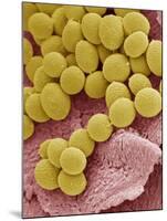 Athlete's Foot Fungus, SEM-Steve Gschmeissner-Mounted Photographic Print