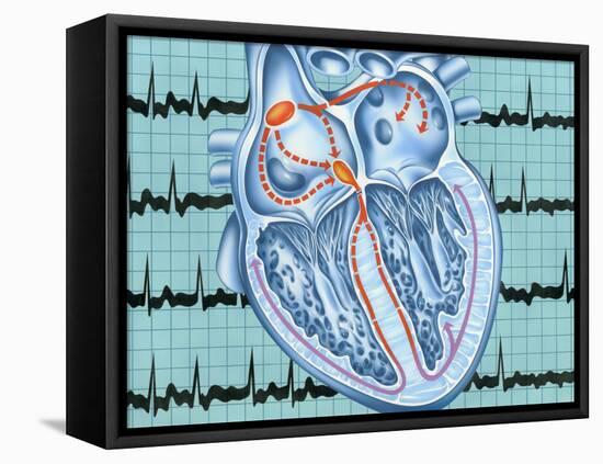 Atrial Fibrillation-John Bavosi-Framed Stretched Canvas