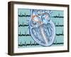 Atrial Fibrillation-John Bavosi-Framed Photographic Print