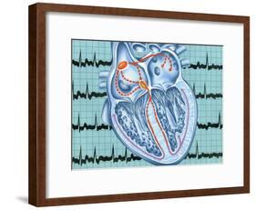 Atrial Fibrillation-John Bavosi-Framed Photographic Print