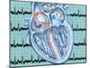 Atrial Fibrillation-John Bavosi-Mounted Photographic Print