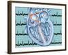 Atrial Fibrillation-John Bavosi-Framed Photographic Print