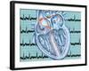 Atrial Fibrillation-John Bavosi-Framed Photographic Print