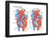 Atrial Septal Defect-Encyclopaedia Britannica-Framed Poster