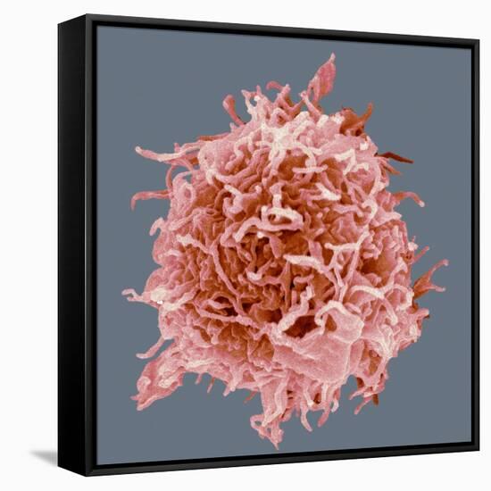 B-cell, SEM-Steve Gschmeissner-Framed Stretched Canvas