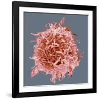 B-cell, SEM-Steve Gschmeissner-Framed Photographic Print