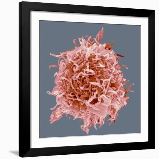 B-cell, SEM-Steve Gschmeissner-Framed Photographic Print