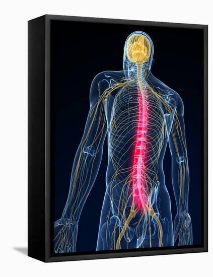 Back Pain, Conceptual Artwork-SCIEPRO-Framed Stretched Canvas