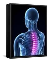 Back Pain, Conceptual Artwork-SCIEPRO-Framed Stretched Canvas