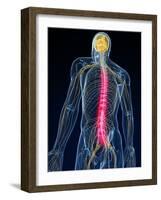 Back Pain, Conceptual Artwork-SCIEPRO-Framed Photographic Print