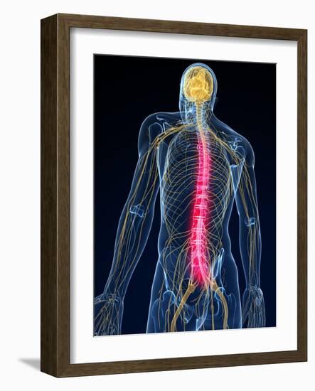 Back Pain, Conceptual Artwork-SCIEPRO-Framed Photographic Print