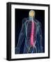 Back Pain, Conceptual Artwork-SCIEPRO-Framed Photographic Print