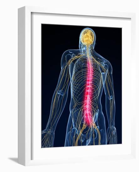 Back Pain, Conceptual Artwork-SCIEPRO-Framed Photographic Print