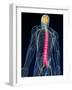 Back Pain, Conceptual Artwork-SCIEPRO-Framed Photographic Print