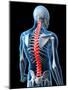 Back Pain, Conceptual Artwork-SCIEPRO-Mounted Photographic Print