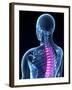 Back Pain, Conceptual Artwork-SCIEPRO-Framed Photographic Print