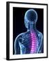 Back Pain, Conceptual Artwork-SCIEPRO-Framed Photographic Print