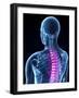 Back Pain, Conceptual Artwork-SCIEPRO-Framed Photographic Print