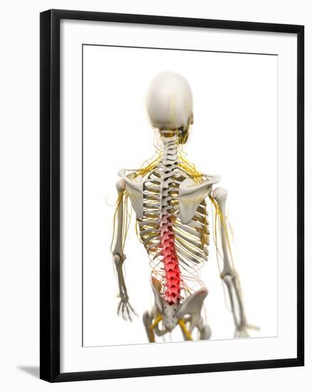 Back Pain, Conceptual Artwork-SCIEPRO-Framed Photographic Print