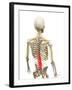 Back Pain, Conceptual Artwork-SCIEPRO-Framed Photographic Print