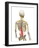 Back Pain, Conceptual Artwork-SCIEPRO-Framed Photographic Print