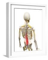 Back Pain, Conceptual Artwork-SCIEPRO-Framed Photographic Print