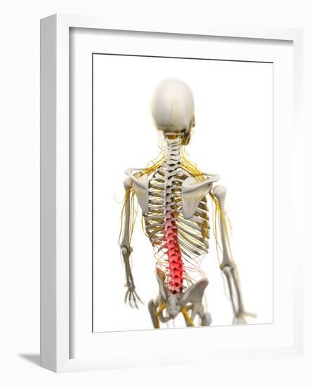 Back Pain, Conceptual Artwork-SCIEPRO-Framed Photographic Print