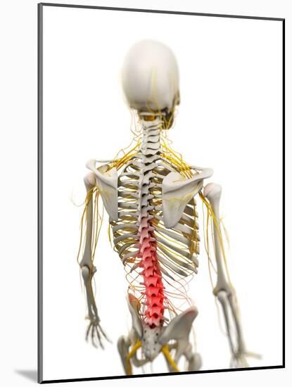 Back Pain, Conceptual Artwork-SCIEPRO-Mounted Photographic Print