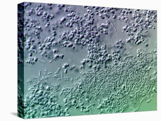 Bacterial Biofilm, Light Micrograph-Science Photo Library-Stretched Canvas