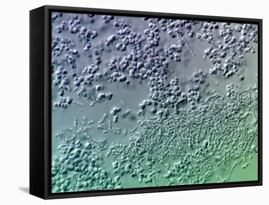 Bacterial Biofilm, Light Micrograph-Science Photo Library-Framed Stretched Canvas
