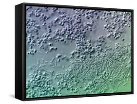 Bacterial Biofilm, Light Micrograph-Science Photo Library-Framed Stretched Canvas
