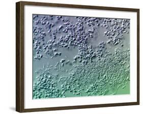 Bacterial Biofilm, Light Micrograph-Science Photo Library-Framed Photographic Print