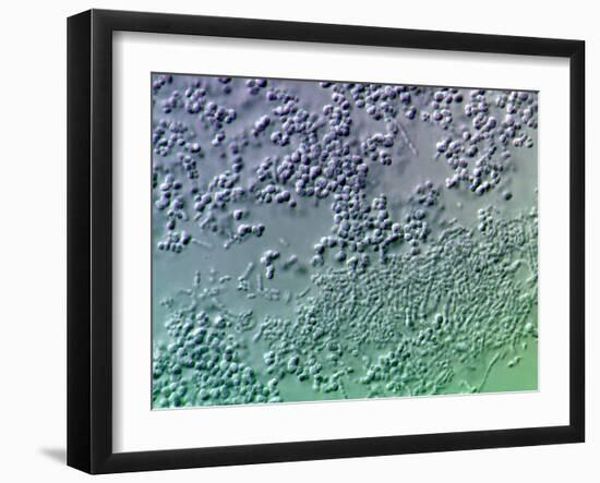 Bacterial Biofilm, Light Micrograph-Science Photo Library-Framed Photographic Print