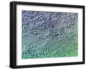 Bacterial Biofilm, Light Micrograph-Science Photo Library-Framed Photographic Print