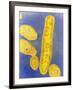Bacteroides Fragilis Bacteria-null-Framed Photographic Print