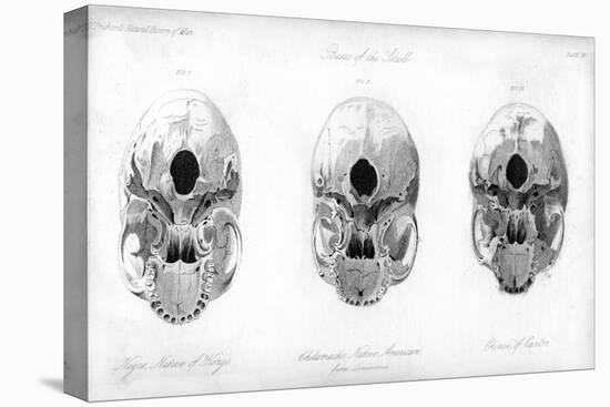 Base of the Skull, 1848-null-Stretched Canvas